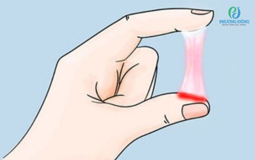 Dịch âm đạo là gì? Cách chăm sóc và sạch dịch âm đạo tại nhà