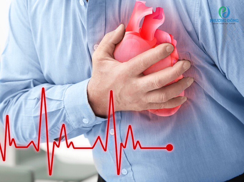 Hội chứng Brugada vô cùng nguy hiểm, có thể dẫn dẫn đến ngừng tim đột ngột