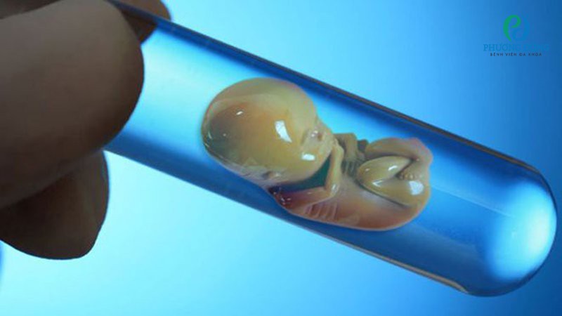 Thai IVF còn được gọi là thai thụ tinh trong ống nghiệm