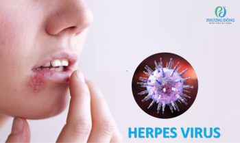 Virus herpes gây bệnh gì? Và làm sao để nhận biết và điều trị sớm?