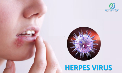 Virus herpes gây bệnh gì? Và làm sao để nhận biết và điều trị sớm?