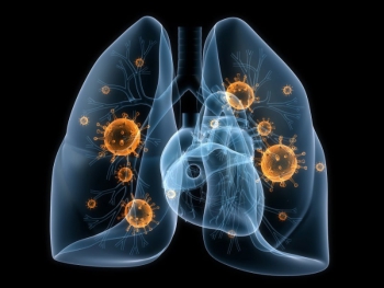 Bệnh phổi kẽ có những loại nào? Nguyên nhân và cách chữa trị  
