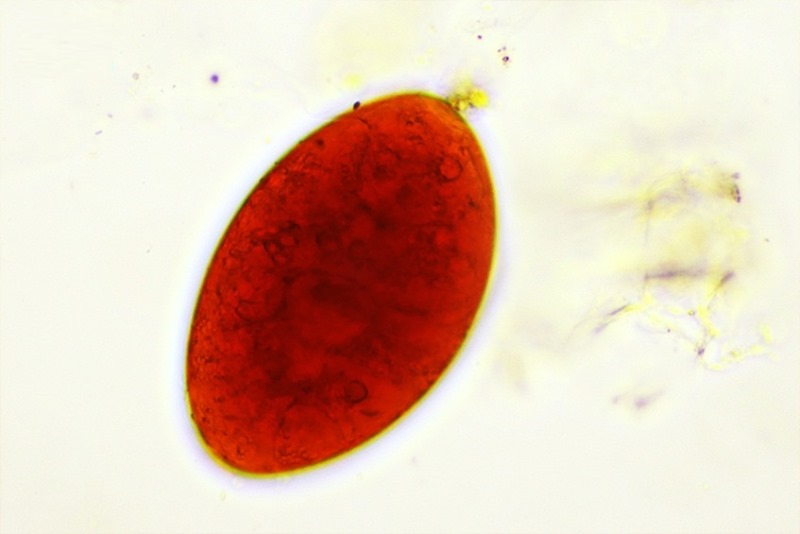 Bệnh sán lá phổi là tình trạng người bị ký sinh bởi loài Paragonimus heterotremus