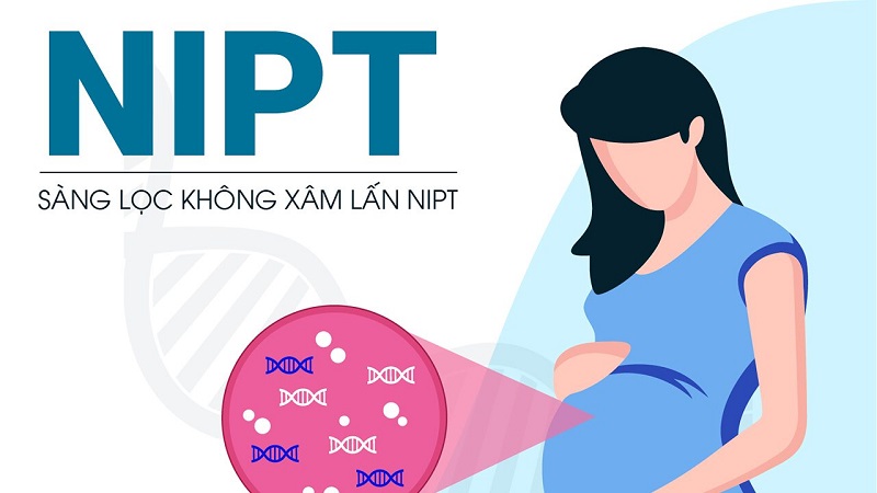 NIPT là phương pháp xét nghiệm sàng lọc dị tật cho thai nhi tốt nhất hiện nay