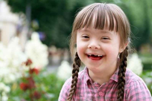 Hội chứng siêu nữ là bệnh gì, nguyên nhân và các dấu hiệu nhận biết