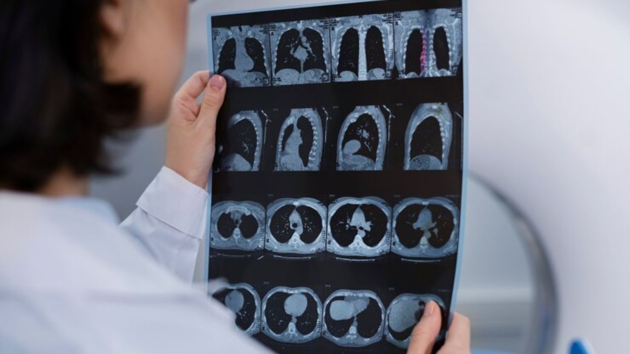 Chụp CT giúp phát hiện nhiều bất thường của cơ thể