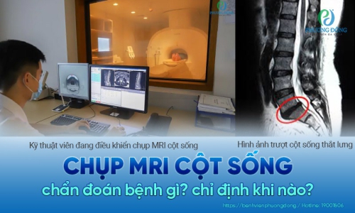 Chụp MRI cột sống là gì? Vai trò của chụp cộng hưởng từ cột sống