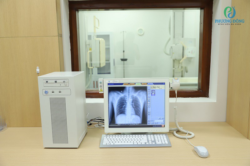 Phòng chụp x quang hiện đại tại Phương Đông