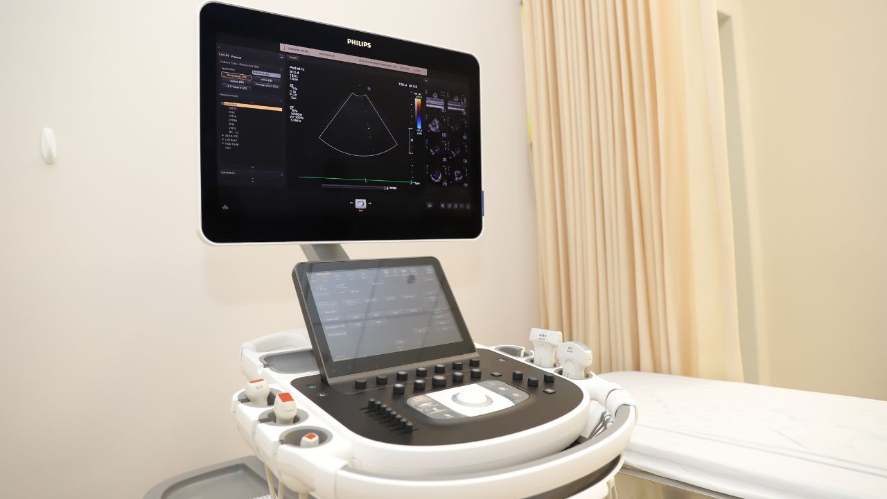 (Hình 8 - Cận cảnh máy siêu âm Affiniti 30 sử dụng trong siêu âm dạ dày tại Bệnh viện Phương Đông)