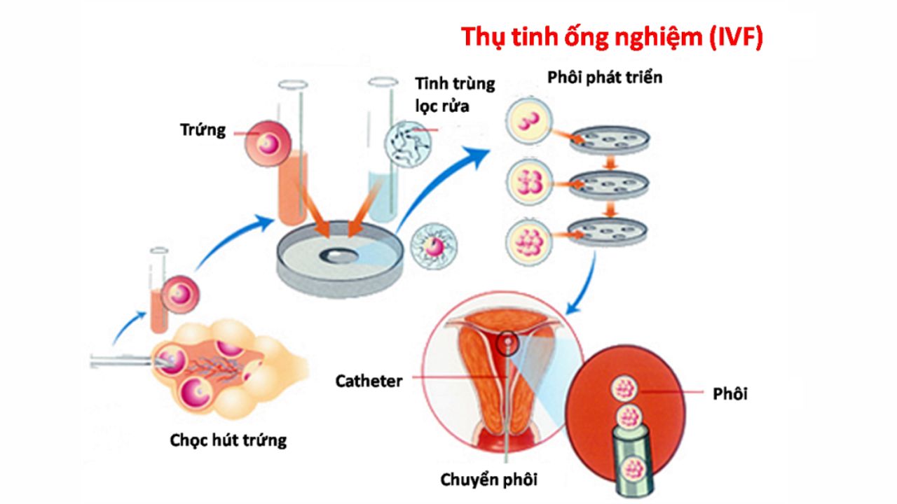 (Hình 3 - Thai nhi từ quá trình thụ tinh nhân tạo nên siêu âm tim thai sớm)