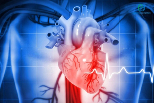 Suy tim cấp: hiểm hoạ của bệnh và cách điều trị 