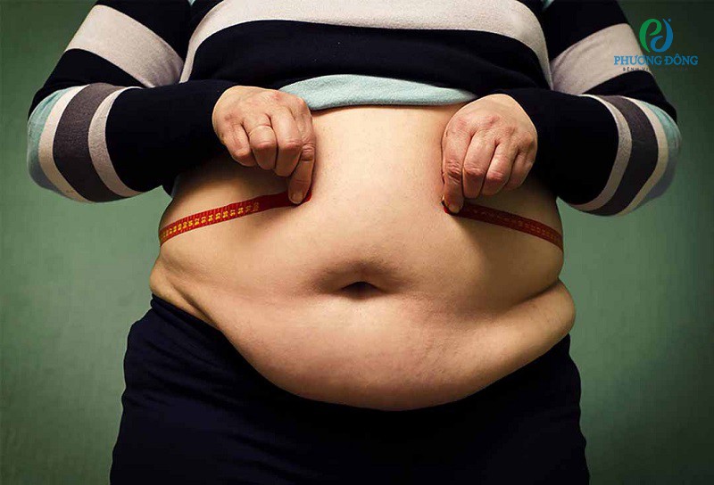 Người béo phì có nguy cơ cao mắc bệnh thoát vị đĩa đệm