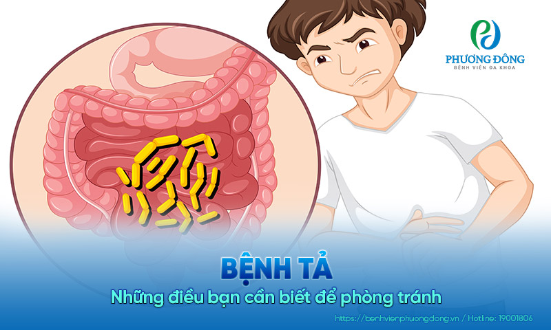 Bệnh tả và những điều bạn cần biết