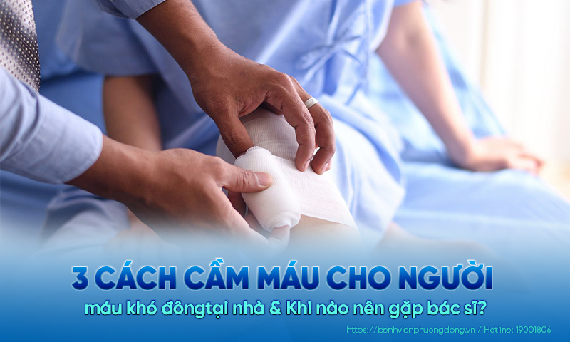 3 cách cầm máu cho người máu khó đông tại nhà & Khi nào nên gặp bác sĩ?