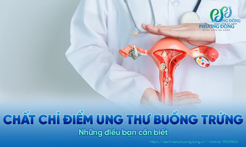 Những điều bạn cần biết về chất chỉ điểm ung thư buồng trứng