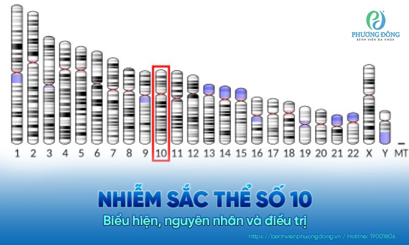 Nhiễm sắc thể số 10: Biểu hiện, nguyên nhân và điều trị