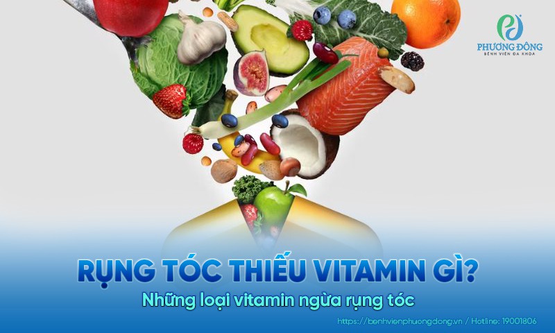 Rụng tóc thiếu vitamin gì? Những loại vitamin ngừa rụng tóc