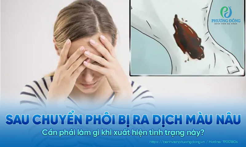 Sau chuyển phôi bị ra dịch màu nâu - dấu hiệu của chuyển phôi thành công