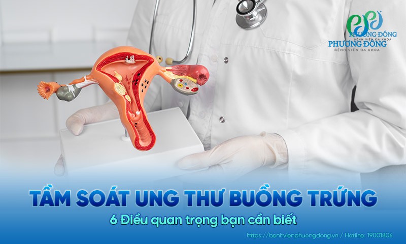 Tầm soát ung thư buồng trứng: 6 Điều quan trọng bạn cần biết