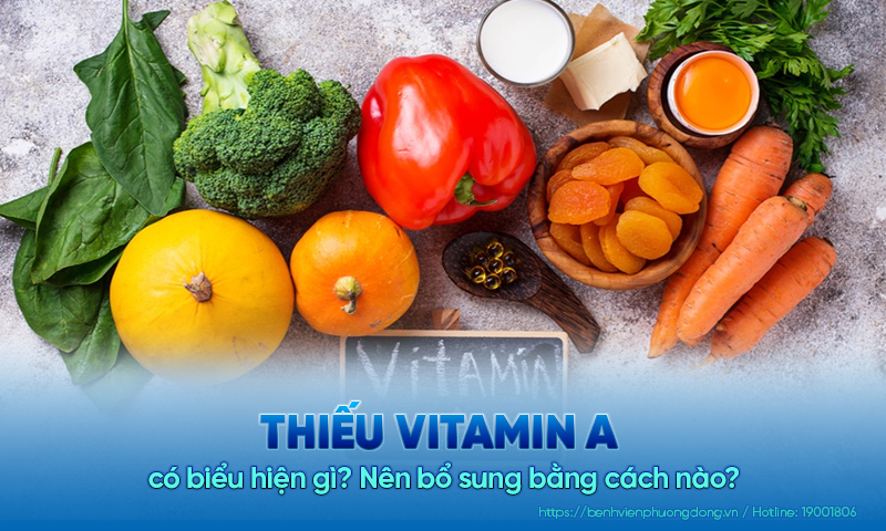 Thiếu vitamin A có những biểu hiện gì? Nên bổ sung bằng cách nào?