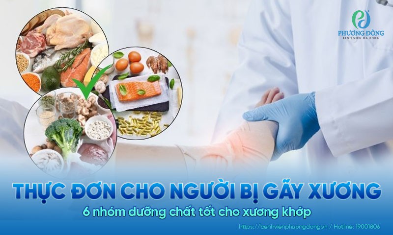 Thực đơn cho người bị gãy xương. 6 nhóm dưỡng chất tốt cho xương khớp