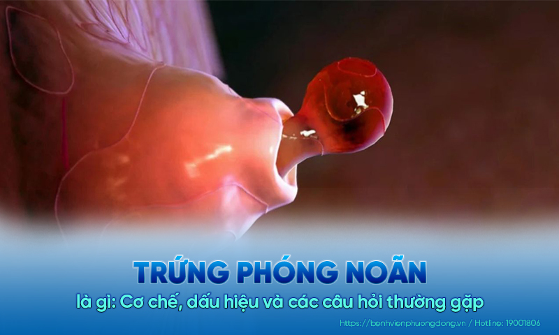 Trứng phóng noãn là gì: Cơ chế, dấu hiệu và các câu hỏi thường gặp