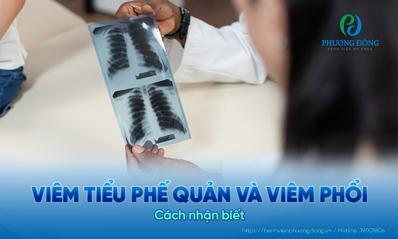 Nhận biết: Viêm tiểu phế quản và viêm phổi