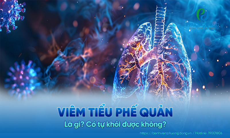 Viêm tiểu phế quản là gì? Có tự khỏi được không? 