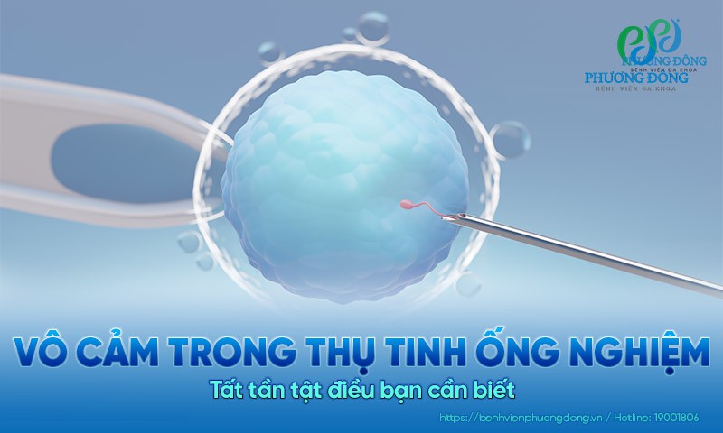 Tất tần tật về vô cảm trong thụ tinh ống nghiệm (IVF)