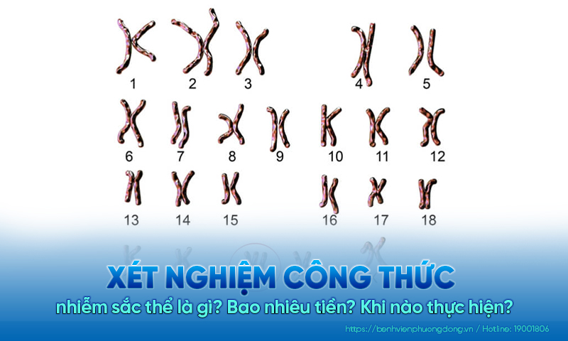 Xét nghiệm công thức nhiễm sắc thể là gì? Hết bao nhiêu tiền? Khi nào thực hiện?