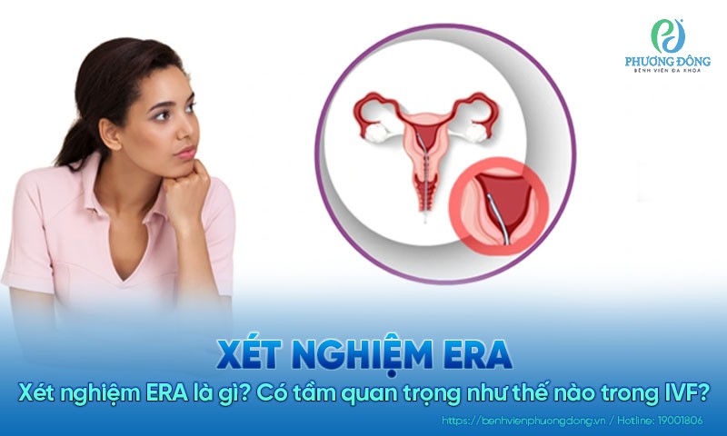 Xét nghiệm ERA là gì? Ý nghĩa và đối tượng thực hiện 