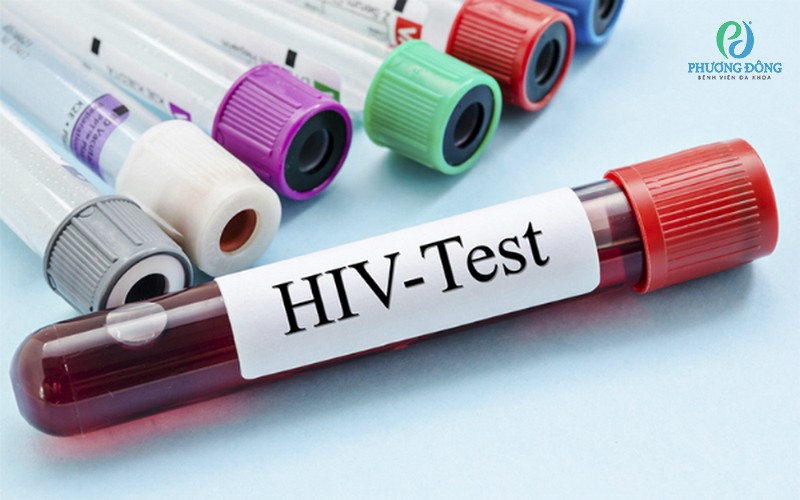 Xét nghiệm máu bình thường có phát hiện HIV không?