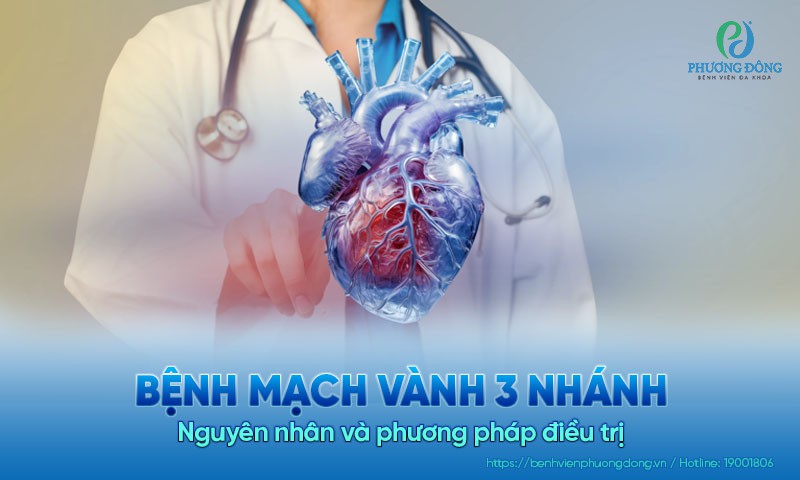 Bệnh mạch vành 3 nhánh: Nguyên nhân và phương pháp điều trị