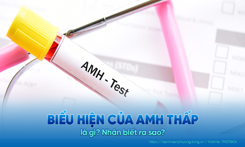 Biểu hiện của AMH thấp là gì? Nhận biết ra sao?