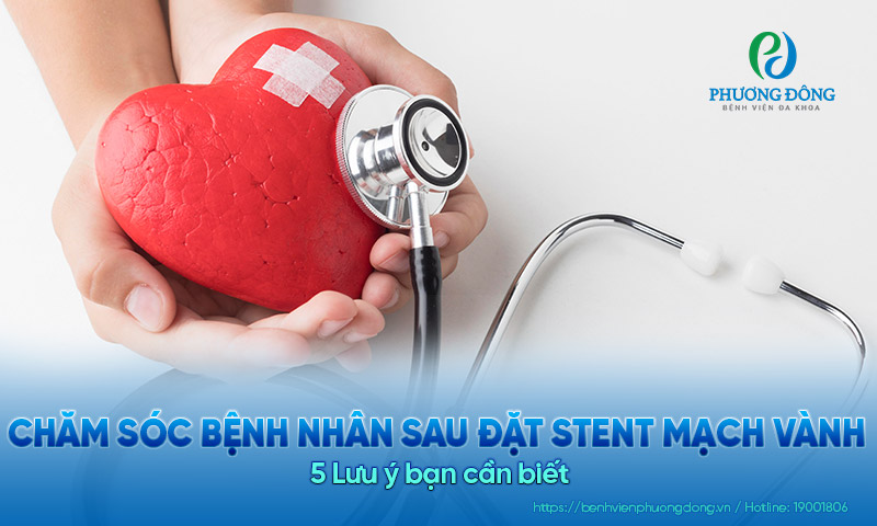 5 Lưu ý khi chăm sóc bệnh nhân sau đặt stent mạch vành bạn cần biết 