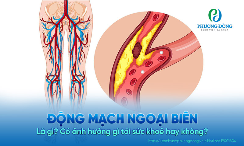 Động mạch ngoại biên là gì? Có ảnh hưởng gì tới sức khoẻ hay không?