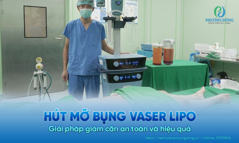 Hút mỡ bụng Vaser Lipo - Giải pháp giảm cân an toàn, hiệu quả