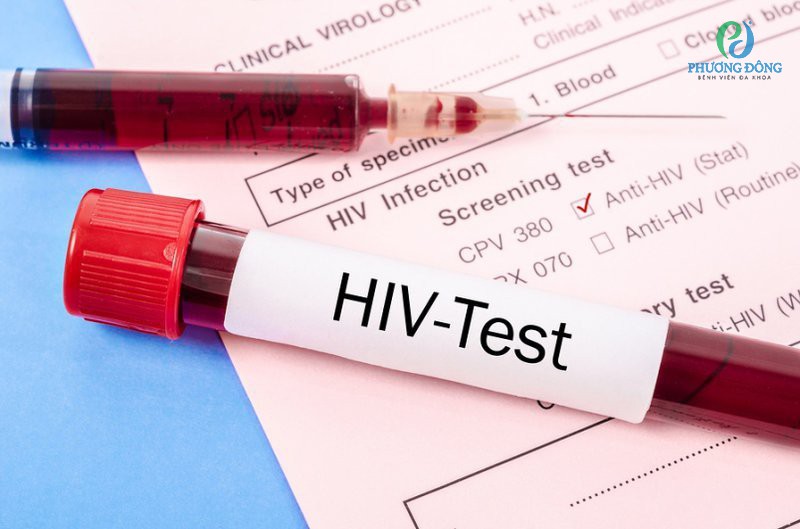 Khám thai có xét nghiệm HIV không? Quy trình xét nghiệm ra sao?