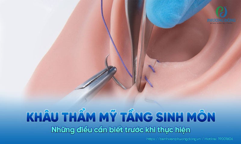 Những điều cần biết về khâu thẩm mỹ tầng sinh môn