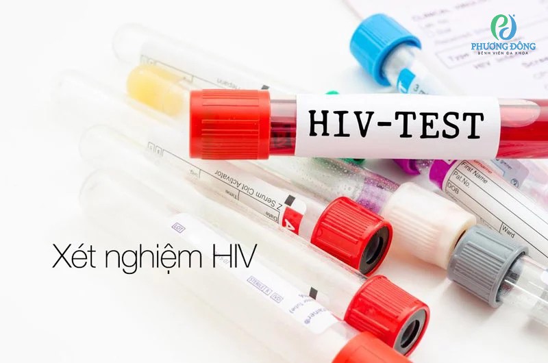 Mổ đẻ có xét nghiệm HIV không? Cần làm thêm xét nghiệm gì?