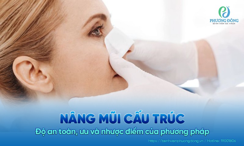 Nâng mũi cấu trúc: Độ an toàn, ưu và nhược điểm của phương pháp