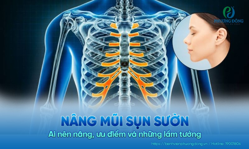 Nâng mũi sụn sườn: Ai nên nâng, ưu điểm và những lầm tưởng