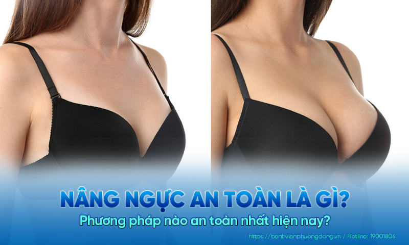 Nâng ngực an toàn là gì? Phương pháp nào an toàn nhất hiện nay?