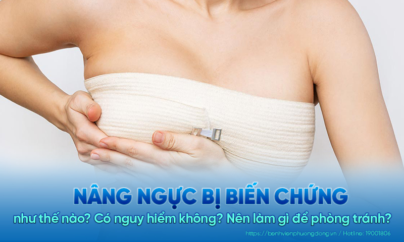 Nâng ngực bị biến chứng như thế nào? Có nguy hiểm không? Nên làm gì để phòng tránh?