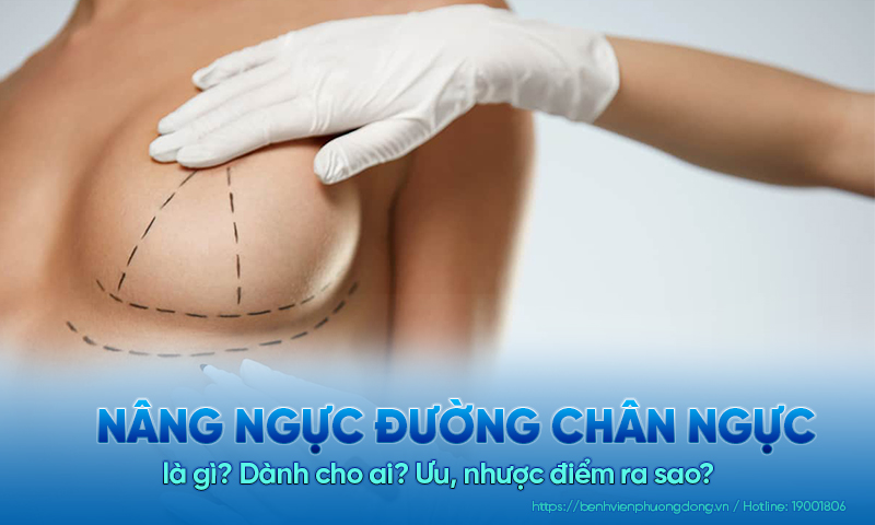 Nâng ngực đường chân ngực là gì? Dành cho ai? Ưu, nhược điểm ra sao?