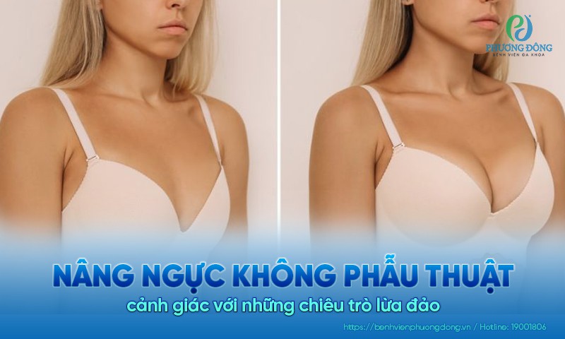 Cảnh báo chiêu trò nâng ngực không phẫu thuật