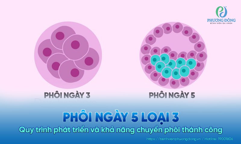 Phôi ngày 5 loại 3: Quy trình phát triển và khả năng chuyển phôi thành công