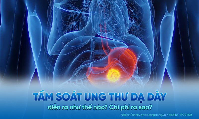 Tầm soát ung thư dạ dày diễn ra như thế nào? Chi phí ra sao?