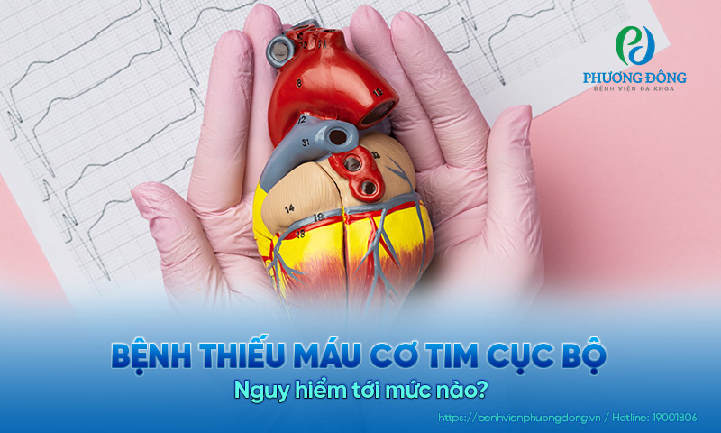 Bệnh thiếu máu cơ tim cục bộ: Nguy hiểm tới mức nào? 