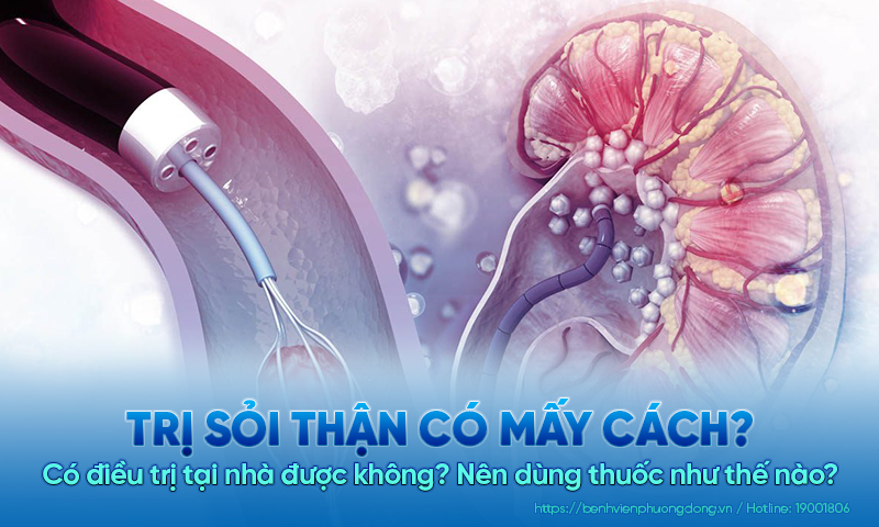 Trị sỏi thận có mấy cách? Có điều trị tại nhà được không? Nên dùng thuốc như thế nào?